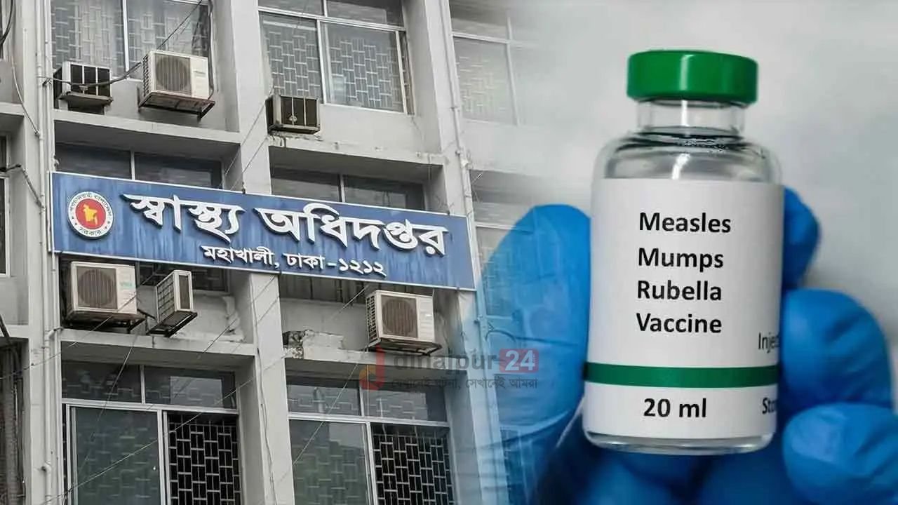 হাম ও হামের উপসর্গ নিয়ে আরও ১১ শিশুর মৃত্যু